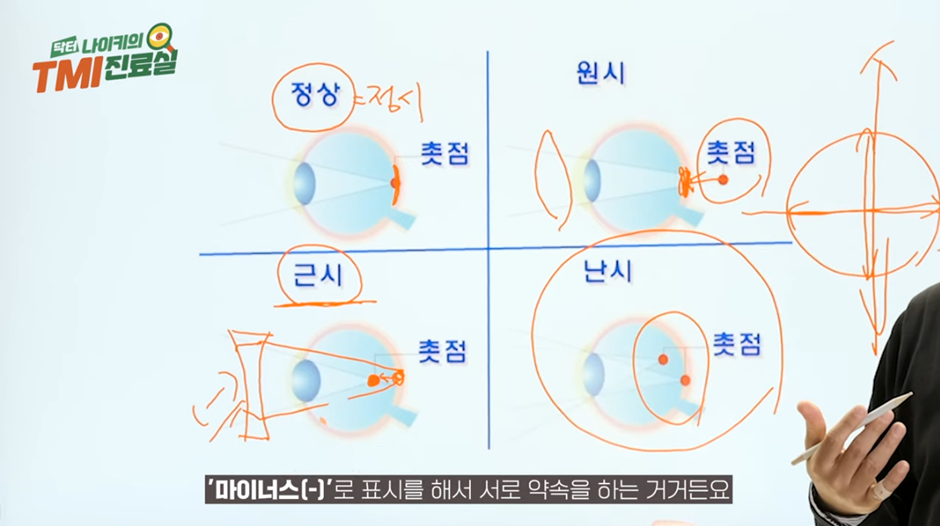 시력에는 마이너스가 없다? 내 시력을 표현하는 방법3