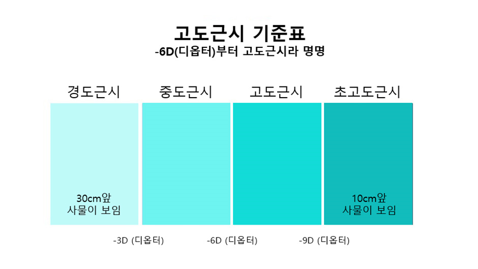 초고도근시라섹 걱정된다면 대안은?