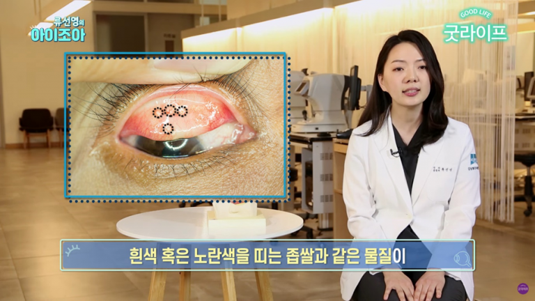 눈에 모래가 들어간 것 같은 결막결석! 자연치유 가능할까? - The 비앤빛 블로그