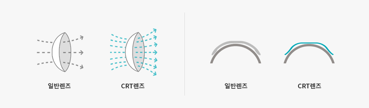 PARAGON CRT 렌즈의 특별함