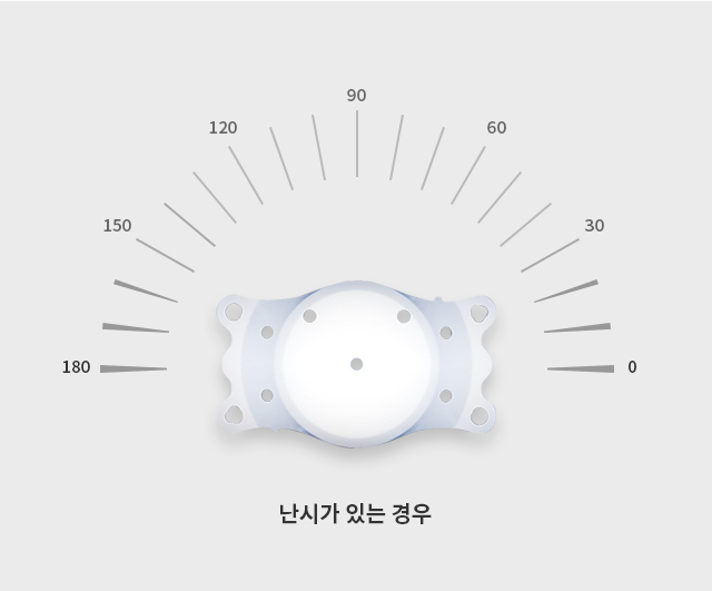 난시 교정용후방렌즈 토릭 ECHO